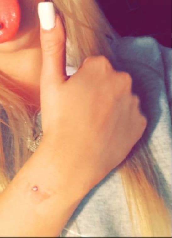 Wrist Dermal Piercing