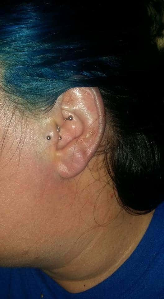 Ear Piercing for Migraine Relief