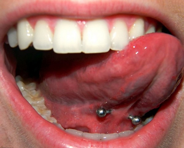 Tongue Web Piercing Risks